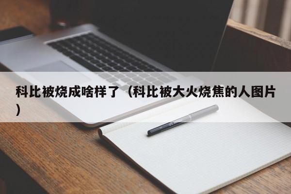 科比被烧成啥样了（科比被大火烧焦的人图片）